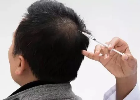 احیای ساقه مو با کمک آنزیم تراپی مو, مواد آنزیم تراپی مو, آنزیم تراپی مو