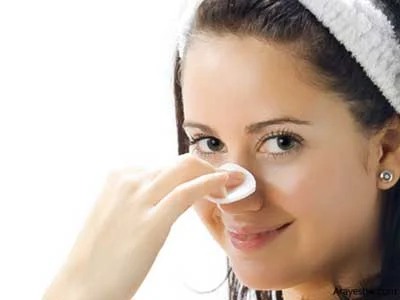 جوش های سرسیاه, از بین بردن جوشهای سرسیاه
