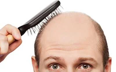 جلوگیری از ریزش مو