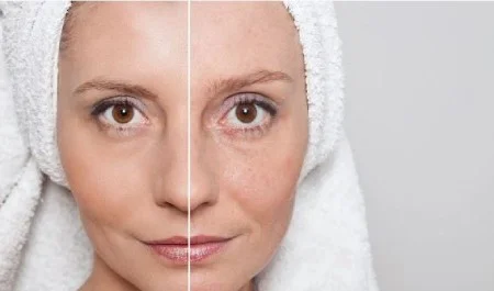 سبک زندگی مناسب برای پوستهای حساس