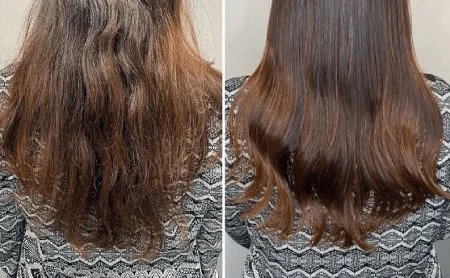 رفع موخوره بدون نیاز به کوتاهی