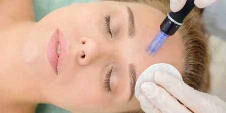 میکرونیدلینگ چه کاری انجام میدهد, میکرونیدلینگ,مزایای میکرونیدلینگ