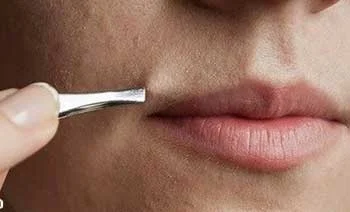 شایعترین عوارض موهای زیر پوستی