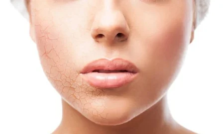 آبرسانی پوست ,آبرسانی به پوست , آبرسانی پوست صورت