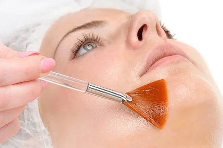 عوارض اسید تراپی پوست, اسید تراپی پوست چرب, مزایای اسید تراپی برای پوست