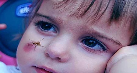 سالک،درمان سالک،عامل بیماری سالک