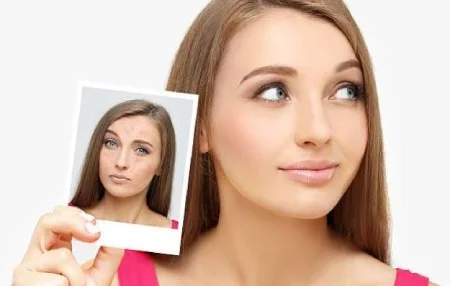 از بین بردن جوش های صورت