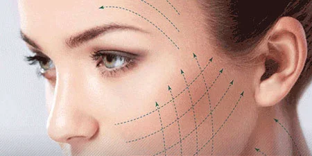 لاغری سریع,دستگاه های لاغری,کاشت نخ