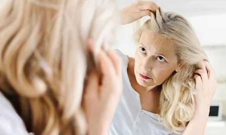 مراقبت از مو بعد از یائسگی, پیشگیری از ریزش مو یائسگی, ریزش مو یائسگی