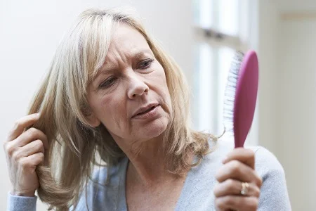 پیشگیری از ریزش مو یائسگی, ریزش مو یائسگی, ریزش مو در دوران یائسگی
