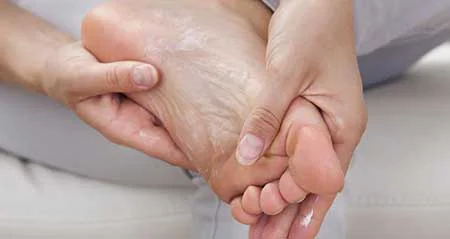 پیشگیری از ترک کف پا