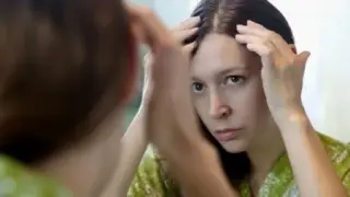 آیا کیست پیلار باعث ریزش مو میشود؟