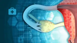 همه‌چیز درباره تراتوما؛ تومور عجیب اما قابل درمان