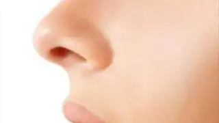 10 عارضه جراحی زیبایی بینی