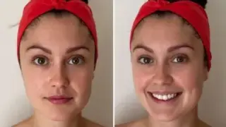 بهترین راههای طبیعی برای چاق شدن صورت