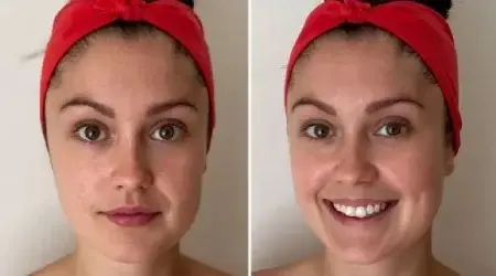بهترین راههای طبیعی برای چاق شدن صورت