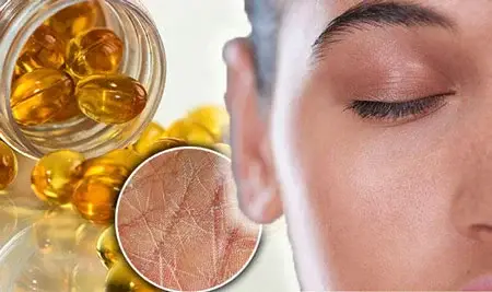 امگا3 را هم بخورید هم به پوستتان بزنید!!