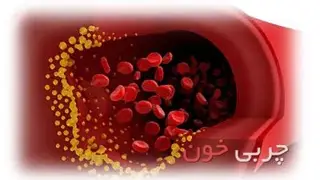 راههایی برای کنترل و پیشگیری از چربی خون