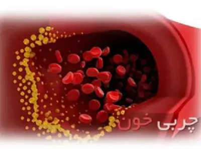 راههایی برای کنترل و پیشگیری از چربی خون