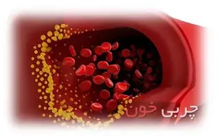 راههایی برای کنترل و پیشگیری از چربی خون