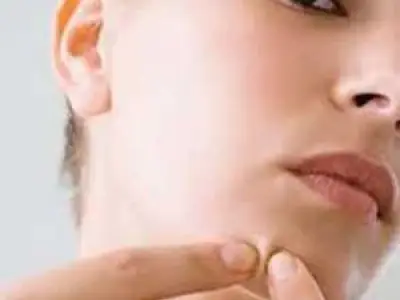 بهترین راه از بین بردن جوش های صورت چیست؟
