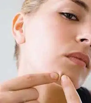 بهترین راه از بین بردن جوش های صورت چیست؟
