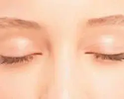 سیاهی دور چشم در سرما بیشتر می‌شود