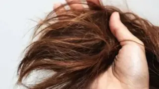 رفع موخوره بدون کوتاهی مو!!