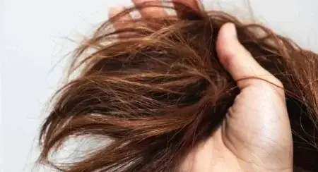 رفع موخوره بدون کوتاهی مو!!