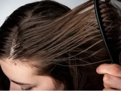 چگونه از موهای چرب خود مراقبت کنیم؟