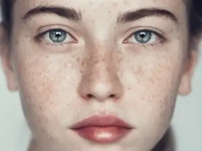 برای لکه های صورت چه کنیم؟ + معرفی چند ماسک صورت خانگی