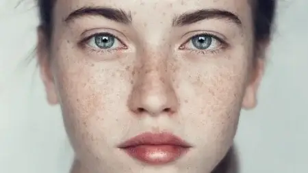 برای لکه های صورت چه کنیم؟ + معرفی چند ماسک صورت خانگی