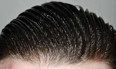 8 دلیل عجیب چرب شدن بیش از حد موها!
