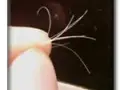 موخوره و درمان آن