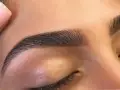کاشت ابرو به روش fut چیست و چه مزایا و معایبی دارد؟