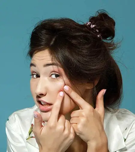 با این روشها یک شبه جوش هایتان را از بین ببرید
