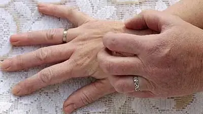 عارضه پوست موسوم به خارش زمستانی