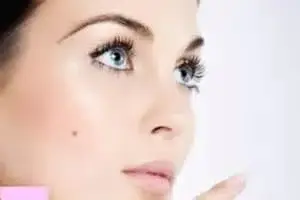 6 سؤالی که درباره خال می‌پرسند