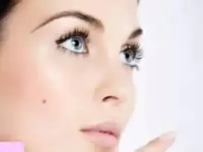 6 سؤالی که درباره خال می‌پرسند