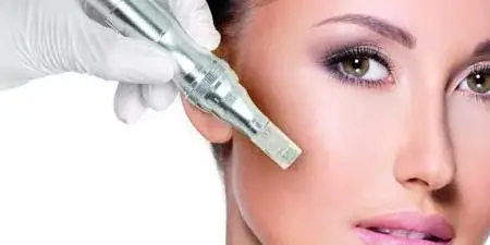 میکرونیدلینگ طبیعی ترین و موثرترین روش جوانسازی و ترمیم پوست