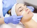 اسید تراپی پوست راهی برای جوانسازی و درمان لک و جوش
