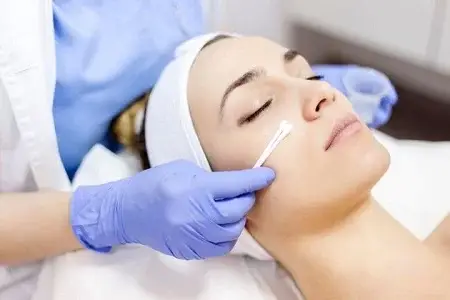 اسید تراپی پوست راهی برای جوانسازی و درمان لک و جوش