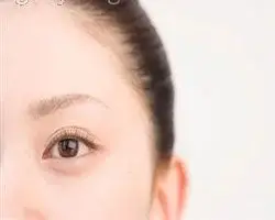 چرا ابروی بعضی‌ها می‌ریزد؟