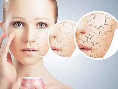 رادیکال آزاد چیست و چطور به پوست آسیب می رساند؟