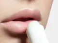 فیلر لب چیست و چه مزایا و عوارضی دارد؟
