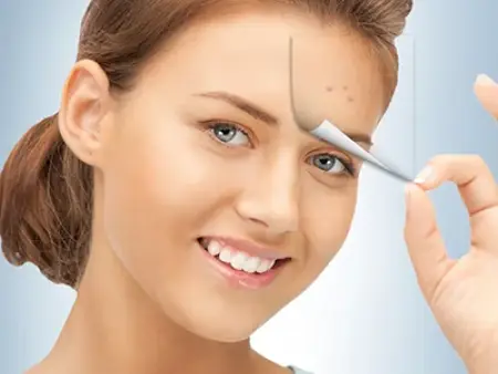 از بین بردن جای جوش با این روغن