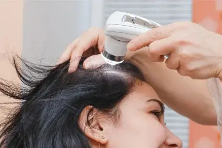 اگزوزوم تراپی مو: مزایا، معایب و اینکه آیا ارزش هزینه کردن دارد