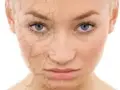 8 باور غلط درباره پوست که نمی دانستید