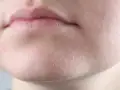 چگونه از خشکی و ترک پوست در نواحی مختلف بدن جلوگیری کنیم؟