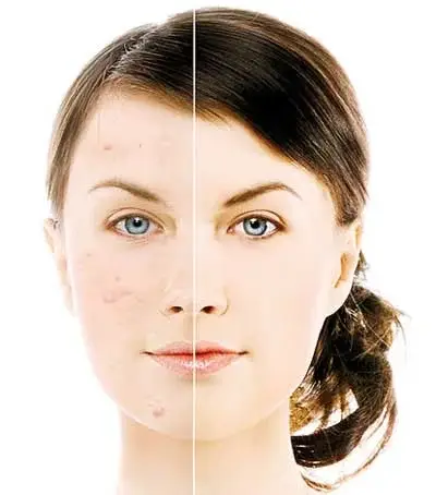 رازهای زیباتر شدن